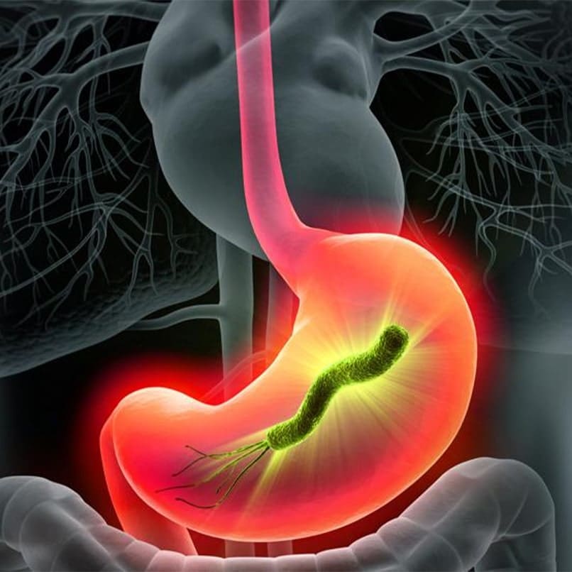 H Pylori Infection